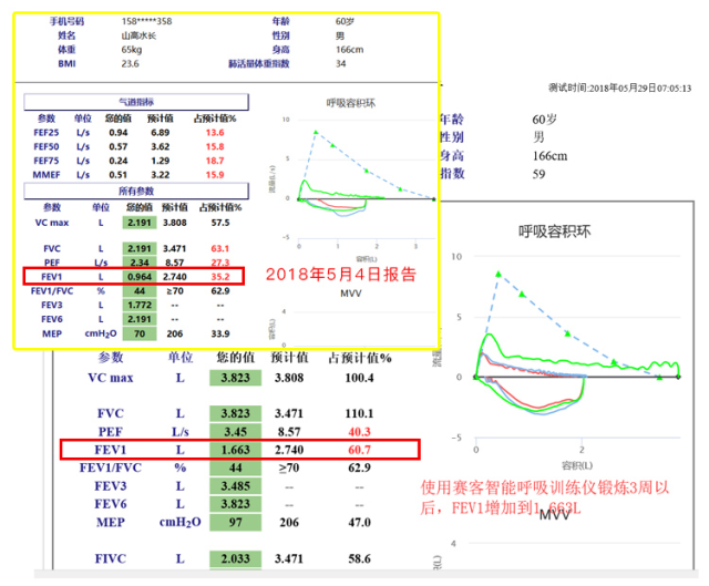 慢阻肺-呼吸訓(xùn)練器-肺功能檢測儀-肺炎-哮喘-海滄-賽客-咳喘