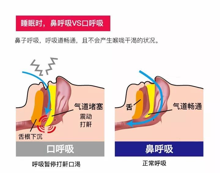 肺炎-哮喘-慢阻肺-咳嗽-咳喘-支氣管炎-肺功能檢測儀-呼吸訓(xùn)練器-心臟病-心血管疾病-口呼吸-整容-呼吸峰流速儀