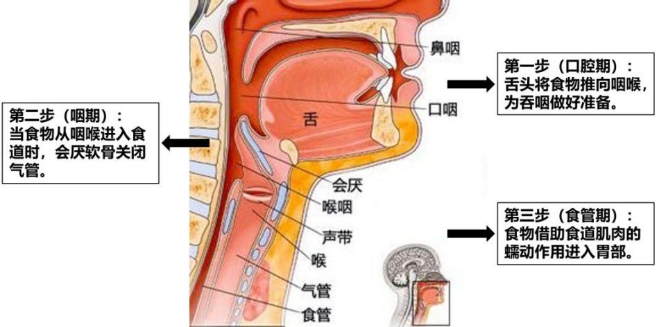 吞咽-吞咽障礙-吃飯-進(jìn)食困難-嗆咳-咳嗽-咳痰-吸入性肺炎-呼吸肌-呼吸機(jī)-冷刺激治療-腹式呼吸-縮唇呼吸-呼吸訓(xùn)練器-唾液吞咽-進(jìn)食體位管理-肺功能-肺功能檢測(cè)儀-肺炎-通氣